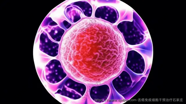 舌癌免疫细胞干预治疗石家庄