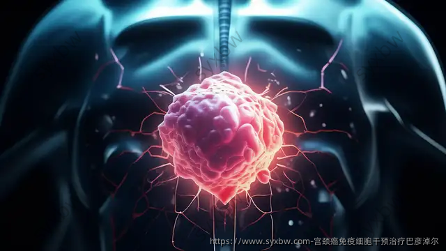 宫颈癌免疫细胞干预治疗巴彦淖尔